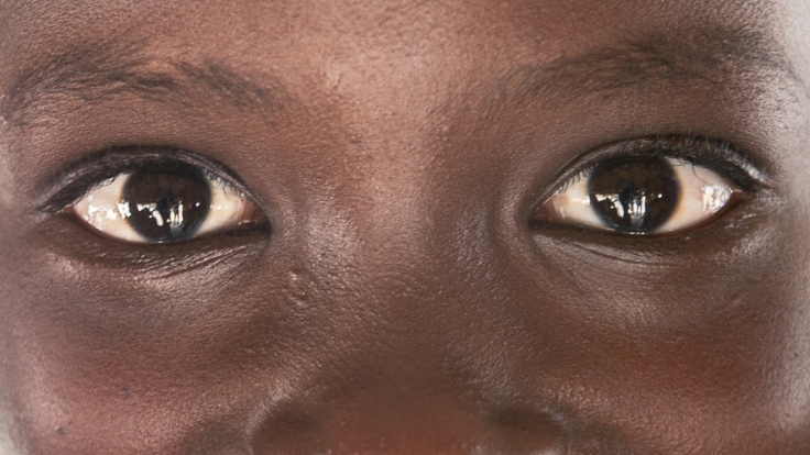Sightsavers-eyes-close-up.jpg